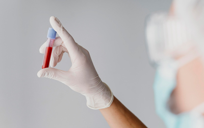 Анализы на наркотики - Квинмед