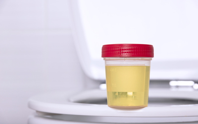 Материалы для сбора анализа - Квинмед